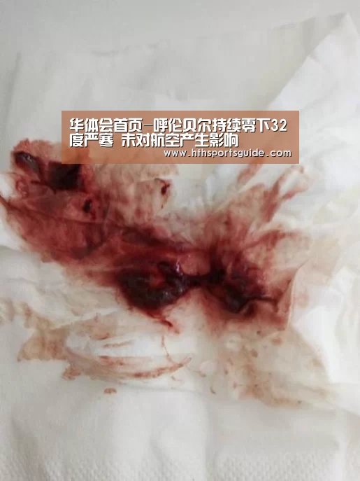 华体会首页-呼伦贝尔持续零下32度严寒 未对航空产生影响(图4)